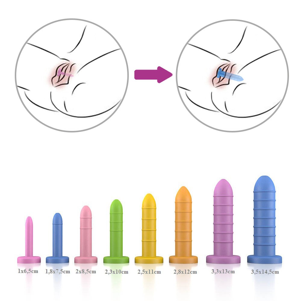 Vista lateral de quatro dilatadores vaginais graduados em PVC toque macio, mostrando os an�is para manuseio