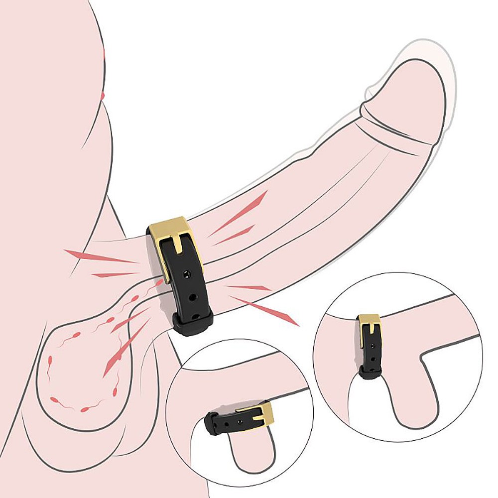 Ilustra��o do Anel Peniano Choker em uso, com setas indicando restri��o do fluxo sangu�neo e prolongamento