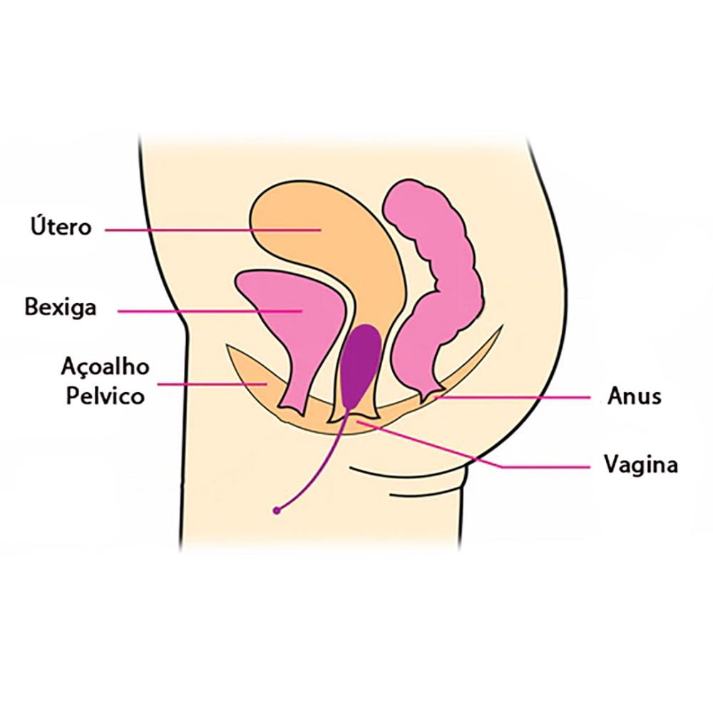 Kit de bolas de pompoarismo em silicone com pesos variados, ideal para exerc�cios de Kegel e fortalecimento p�lvico