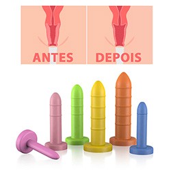 Foto do Produto Kit de Dilatador Vaginal Graduados Anelado 6 Unidades Colorido